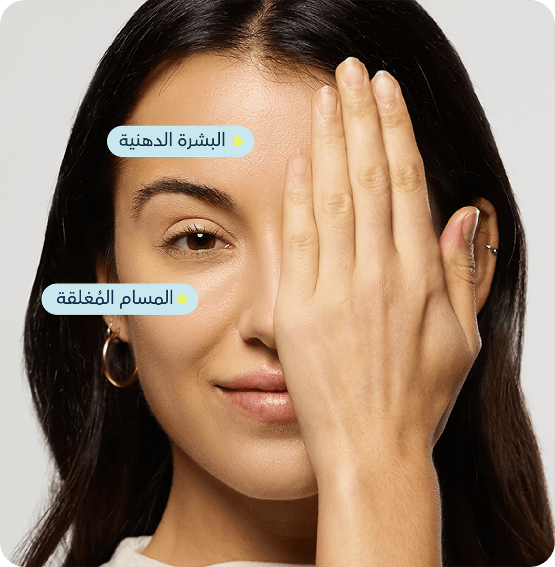 حب الشباب وندباته