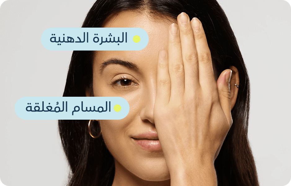 حب الشباب وندباته