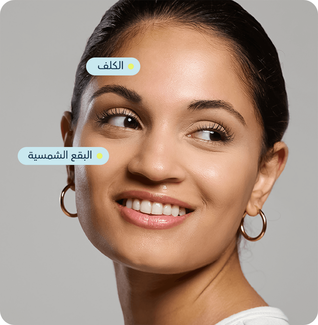 فرط التصبغات